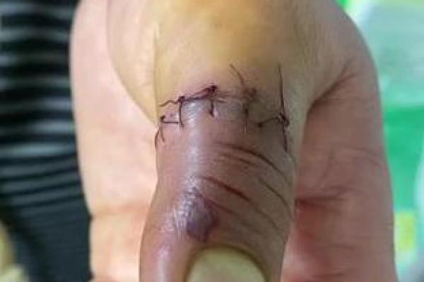 揭秘头上带针的男人是什么命，深邃的命理学解析！