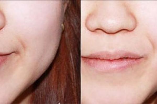 酒窝形状与旺夫命的奇妙关系揭秘