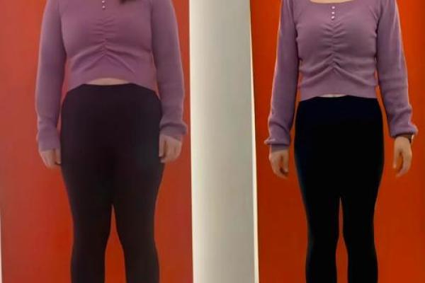 手腿细身体胖,命运与特征的深度解析 手腿细身体胖,命运与特征的深度解析