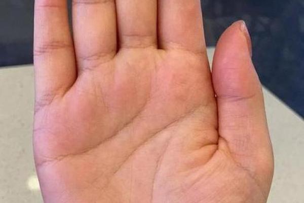 手短粗的女生命运解析:看身体特征与生活轨迹之间的关系 手短粗的女生命运解析:看身体特征与生活轨迹之间的关系