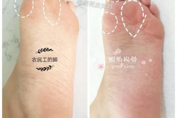 揭示手指甲与脚的秘密,了解你的命运之谜! 揭示手指甲与脚的秘密,了解你的命运之谜!