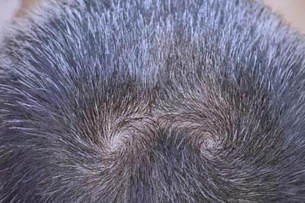 揭秘头上竖着两个旋的命运:它们背后的象征与影响 揭秘头上竖着两个旋的命运:它们背后的象征与影响