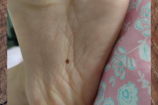 揭秘脚心长痣的神秘寓意:它暗示了你什么命运? 揭秘脚心长痣的神秘寓意:它暗示了你什么命运?