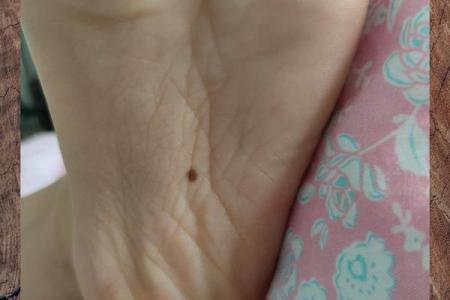 揭秘脚心长痣的神秘寓意：它暗示了你什么命运？