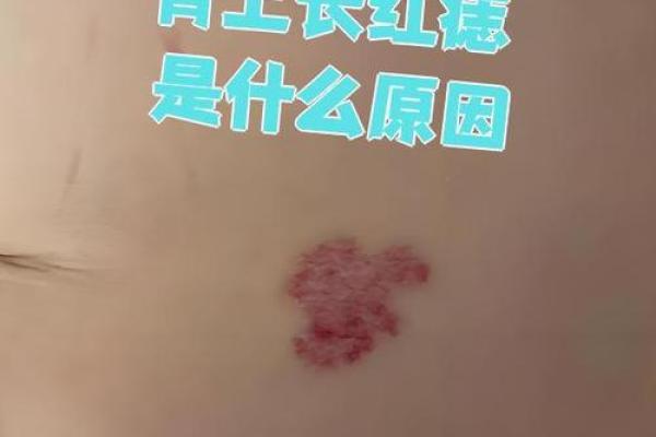 前胸后背长红痣的寓意解析：揭示命运的神秘面纱