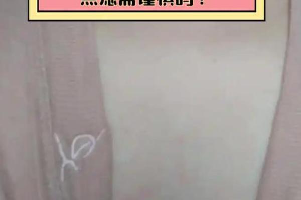 前胸后背长红痣的寓意解析：揭示命运的神秘面纱