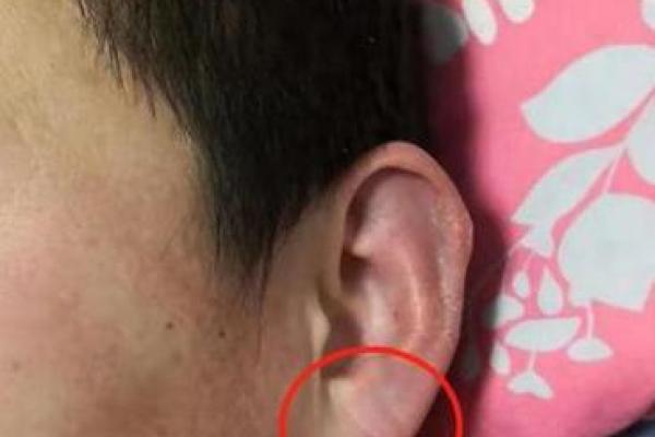 揭秘大耳垂命的奥秘：为何它被认为是好运的象征？