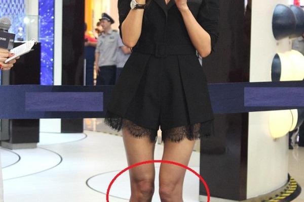 男人膝盖一条纹路的命运解析：隐藏在肤色下的故事