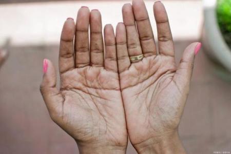 手小手指细短的男人，他们的命运与众不同！