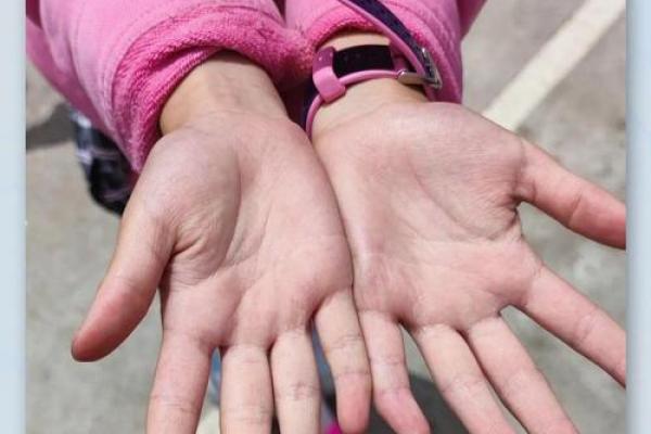 手指细意味着什么?解读手指形状与个性的奥秘 手指细意味着什么?解读手指形状与个性的奥秘