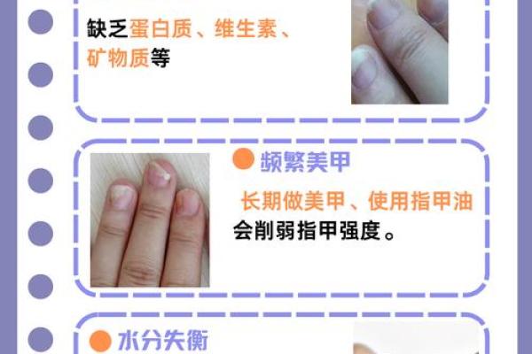 手指甲的凹凸暗示:揭示你性格与命运的秘密 手指甲的凹凸暗示:揭示你性格与命运的秘密