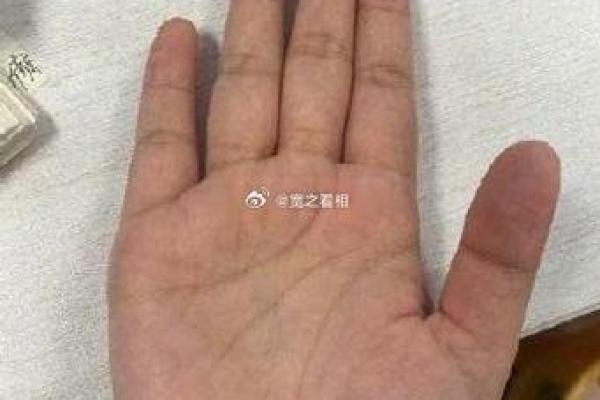 揭秘手相中的川字纹:深藏的命运密码与人生指引 揭秘手相中的川字纹:深藏的命运密码与人生指引
