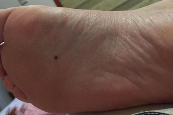 桑松木命最忌讳的命是什么?探秘命理中的禁忌与化解之道 桑松木命最忌讳的命是什么?探秘命理中的禁忌与化解之道