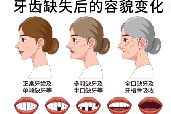 女人的30颗牙齿和她的命运:揭示命理的秘密 女人的30颗牙齿和她的命运:揭示命理的秘密
