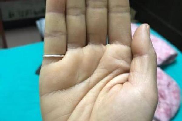 女人食指往中指歪的命理解析与生活影响 女人食指往中指歪的命理解析与生活影响
