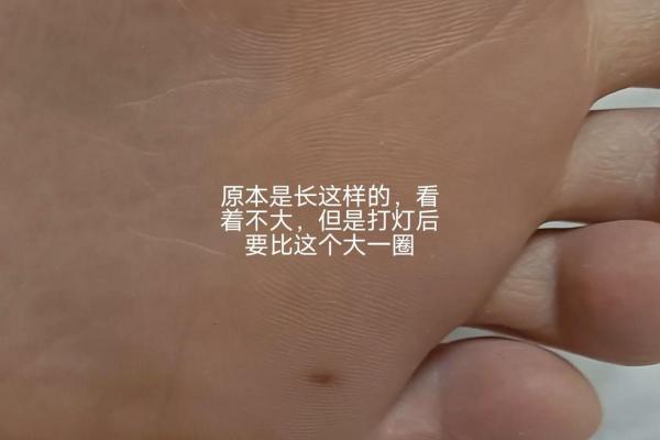 脚心长痣的命理解析：揭开命运之谜，探索脚底的秘密象征