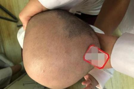 生殖有胎记：揭示命运背后的神秘与启示