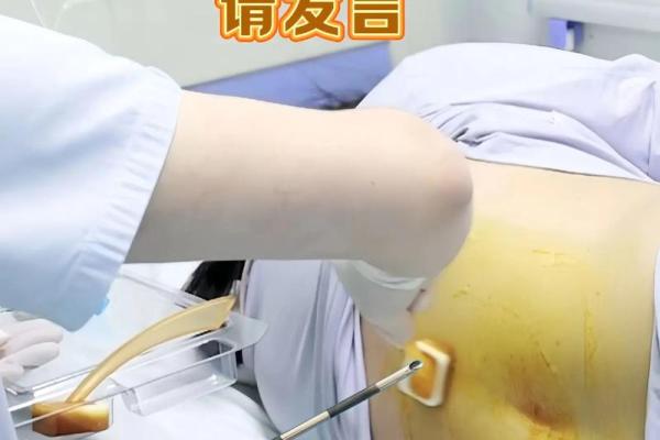 剖腹产孩子命运不如顺产,真相令人深思! 剖腹产孩子命运不如顺产,真相令人深思!