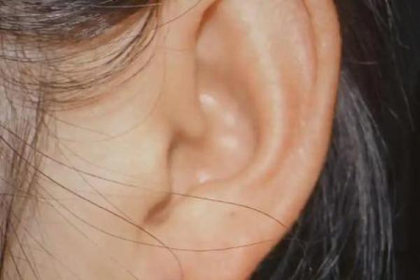 女人耳垂有肉，命运与幸福的秘密探寻